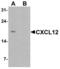 C-X-C Motif Chemokine Ligand 12 antibody, LS-C201162, Lifespan Biosciences, Western Blot image 