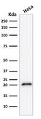 p21 antibody, GTX34924, GeneTex, Western Blot image 