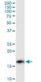 Protein Phosphatase 3 Regulatory Subunit B, Alpha antibody, H00005534-M01, Novus Biologicals, Western Blot image 