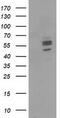 Carnosine Dipeptidase 1 antibody, M06263-1, Boster Biological Technology, Western Blot image 