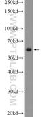 SRC Proto-Oncogene, Non-Receptor Tyrosine Kinase antibody, 25978-1-AP, Proteintech Group, Western Blot image 