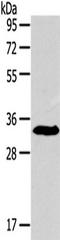 Insulin Like Growth Factor Binding Protein 3 antibody, TA350695, Origene, Western Blot image 