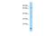 POF1B Actin Binding Protein antibody, A10038, Boster Biological Technology, Western Blot image 