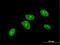 PBX/Knotted 1 Homeobox 1 antibody, H00005316-M07, Novus Biologicals, Immunofluorescence image 