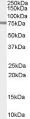 Phosphodiesterase 4D antibody, PA5-18621, Invitrogen Antibodies, Western Blot image 