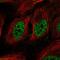 RAD52 Homolog, DNA Repair Protein antibody, PA5-65036, Invitrogen Antibodies, Immunofluorescence image 