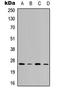 Vesicle Transport Through Interaction With T-SNAREs 1B antibody, LS-C368554, Lifespan Biosciences, Western Blot image 