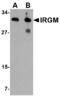 Immunity Related GTPase M antibody, AHP1887, Bio-Rad (formerly AbD Serotec) , Immunohistochemistry paraffin image 
