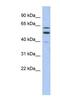 Transmembrane And Coiled-Coil Domain Family 1 antibody, NBP1-59917, Novus Biologicals, Western Blot image 