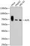 Alkaline Phosphatase, Biomineralization Associated antibody, 13-929, ProSci, Western Blot image 