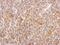 Mitogen-Activated Protein Kinase Kinase 2 antibody, PA5-29291, Invitrogen Antibodies, Immunohistochemistry frozen image 