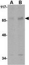 AP2 Associated Kinase 1 antibody, GTX17021, GeneTex, Western Blot image 