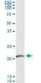 Guanylate Cyclase Activator 1C antibody, H00009626-M03, Novus Biologicals, Immunoprecipitation image 