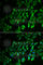 Inositol Polyphosphate-5-Phosphatase J antibody, A6631, ABclonal Technology, Immunofluorescence image 