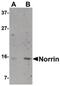 Norrin Cystine Knot Growth Factor NDP antibody, PA5-20722, Invitrogen Antibodies, Western Blot image 