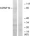 Heterogeneous Nuclear Ribonucleoprotein M antibody, LS-C118926, Lifespan Biosciences, Western Blot image 