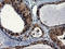 CCR4-NOT Transcription Complex Subunit 4 antibody, LS-C175152, Lifespan Biosciences, Immunohistochemistry paraffin image 