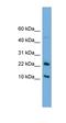 GM2 Ganglioside Activator antibody, orb330459, Biorbyt, Western Blot image 