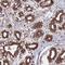 Zinc Finger Protein 618 antibody, NBP1-92635, Novus Biologicals, Immunohistochemistry paraffin image 