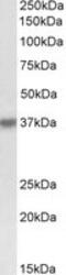 Hematopoietic SH2 Domain Containing antibody, MBS422324, MyBioSource, Western Blot image 
