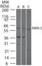 TNF Alpha Induced Protein 3 antibody, PA1-41174, Invitrogen Antibodies, Western Blot image 