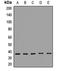 GIPC PDZ Domain Containing Family Member 1 antibody, LS-C668145, Lifespan Biosciences, Western Blot image 