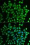 Prolyl 4-Hydroxylase, Transmembrane antibody, LS-C335640, Lifespan Biosciences, Immunofluorescence image 