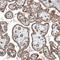 Integrin Subunit Alpha 3 antibody, NBP2-76515, Novus Biologicals, Immunohistochemistry paraffin image 