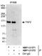 TATA-Box Binding Protein Associated Factor 2 antibody, NBP1-21372, Novus Biologicals, Immunoprecipitation image 
