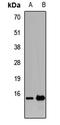 Trafficking Protein Particle Complex 2 antibody, orb411782, Biorbyt, Western Blot image 