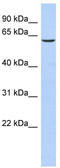 Transketolase Like 1 antibody, TA335653, Origene, Western Blot image 