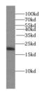 Stathmin 3 antibody, FNab08342, FineTest, Western Blot image 