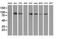 Protein Kinase D2 antibody, MA5-25230, Invitrogen Antibodies, Western Blot image 