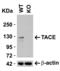 ADAM Metallopeptidase Domain 17 antibody, GTX31632, GeneTex, Western Blot image 