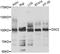 DSC2 antibody, A10211, ABclonal Technology, Western Blot image 