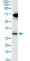 Stanniocalcin 2 antibody, H00008614-M08, Novus Biologicals, Western Blot image 