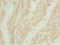 Leucine Zipper Like Transcription Regulator 1 antibody, LS-C676012, Lifespan Biosciences, Immunohistochemistry paraffin image 