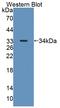 4-Aminobutyrate Aminotransferase antibody, LS-C663444, Lifespan Biosciences, Western Blot image 