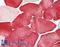 Tissue Specific Transplantation Antigen P35B antibody, LS-B14712, Lifespan Biosciences, Immunohistochemistry paraffin image 