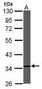 Cytochrome C1 antibody, GTX101717, GeneTex, Western Blot image 