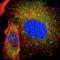 Spleen Associated Tyrosine Kinase antibody, NBP1-86178, Novus Biologicals, Immunocytochemistry image 