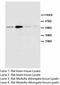 Muscarinic acetylcholine receptor M2 antibody, LS-C172130, Lifespan Biosciences, Western Blot image 
