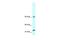 RNA Binding Motif Protein 10 antibody, PA5-40330, Invitrogen Antibodies, Western Blot image 