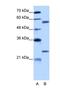 Copine 1 antibody, NBP1-57418, Novus Biologicals, Western Blot image 