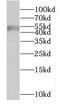 UAP56-interacting factor antibody, FNab03263, FineTest, Western Blot image 