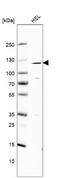Roundabout homolog 2 antibody, NBP1-81399, Novus Biologicals, Western Blot image 