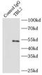 Transducin beta-like protein 2 antibody, FNab08524, FineTest, Immunoprecipitation image 