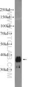 Solute Carrier Family 25 Member 14 antibody, 25223-1-AP, Proteintech Group, Western Blot image 