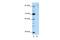 GLIS Family Zinc Finger 3 antibody, PA5-41677, Invitrogen Antibodies, Western Blot image 