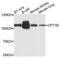 Carnitine Palmitoyltransferase 1C antibody, LS-C334951, Lifespan Biosciences, Western Blot image 